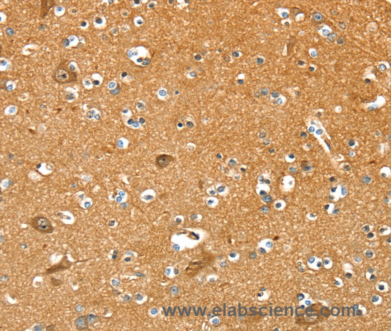 Immunohistochemistry of paraffin-embedded Human brain  using PYGL Polyclonal Antibody at dilution of 1:35