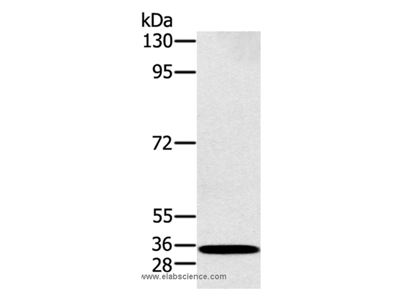 Western Blot analysis of K562 cell using RAB27A Polyclonal Antibody at dilution of 1:400