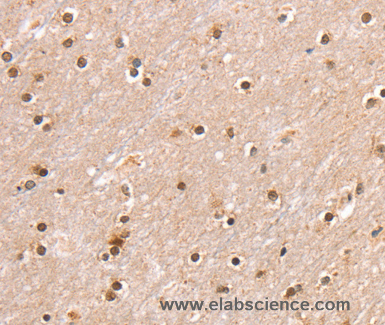 Immunohistochemistry of paraffin-embedded Human brain  using SMARCB1 Polyclonal Antibody at dilution of 1:30