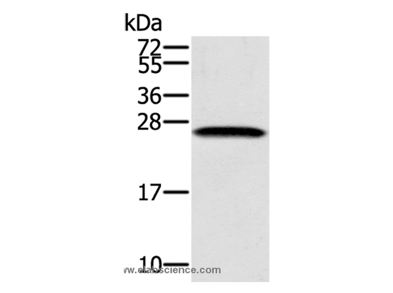 Western Blot analysis of K562 cell using SSX1 Polyclonal Antibody at dilution of 1:400