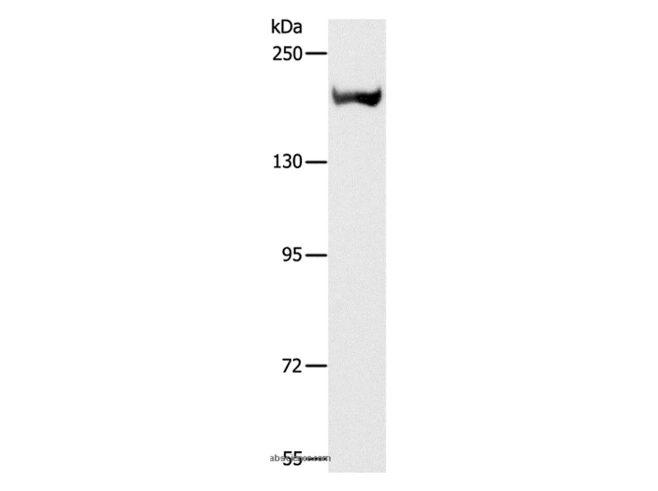 Western Blot analysis of Mouse kidney tissue using ACE1 Polyclonal Antibody at dilution of 1:1000