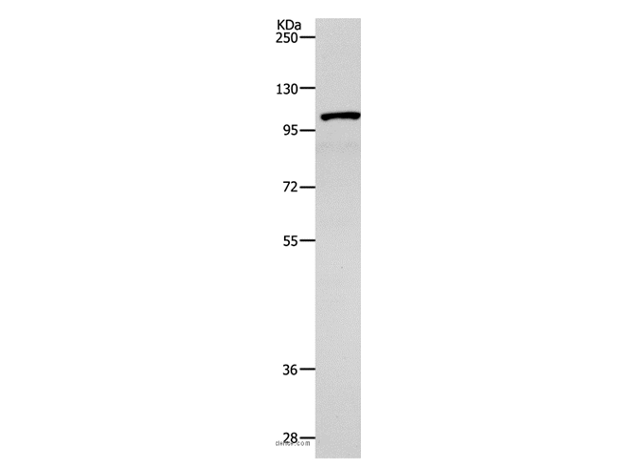 Western Blot analysis of 231 cell using TNK2 Polyclonal Antibody at dilution of 1:1800