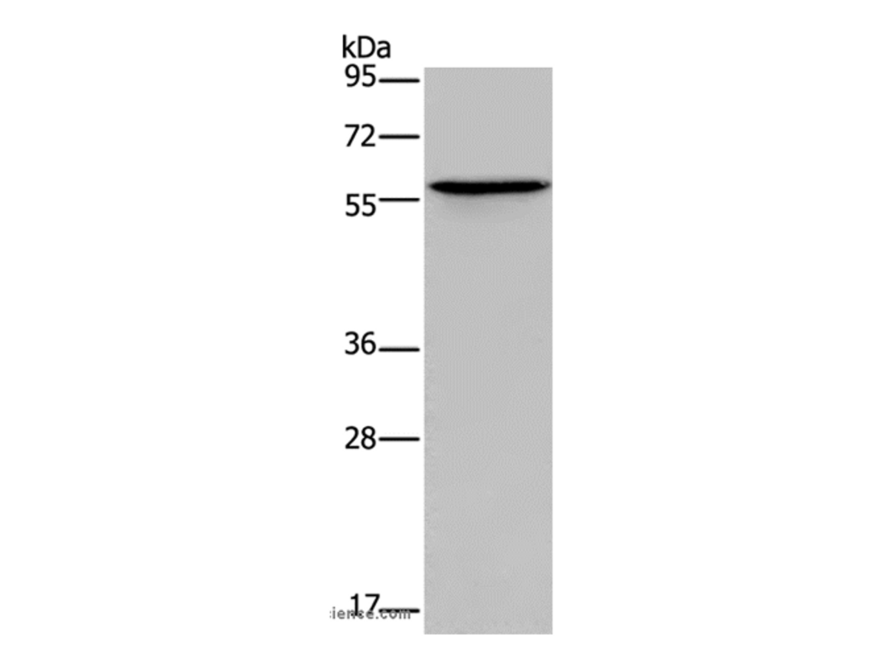 Western Blot analysis of Human lung cancer tissue using ADRA1B Polyclonal Antibody at dilution of 1:550