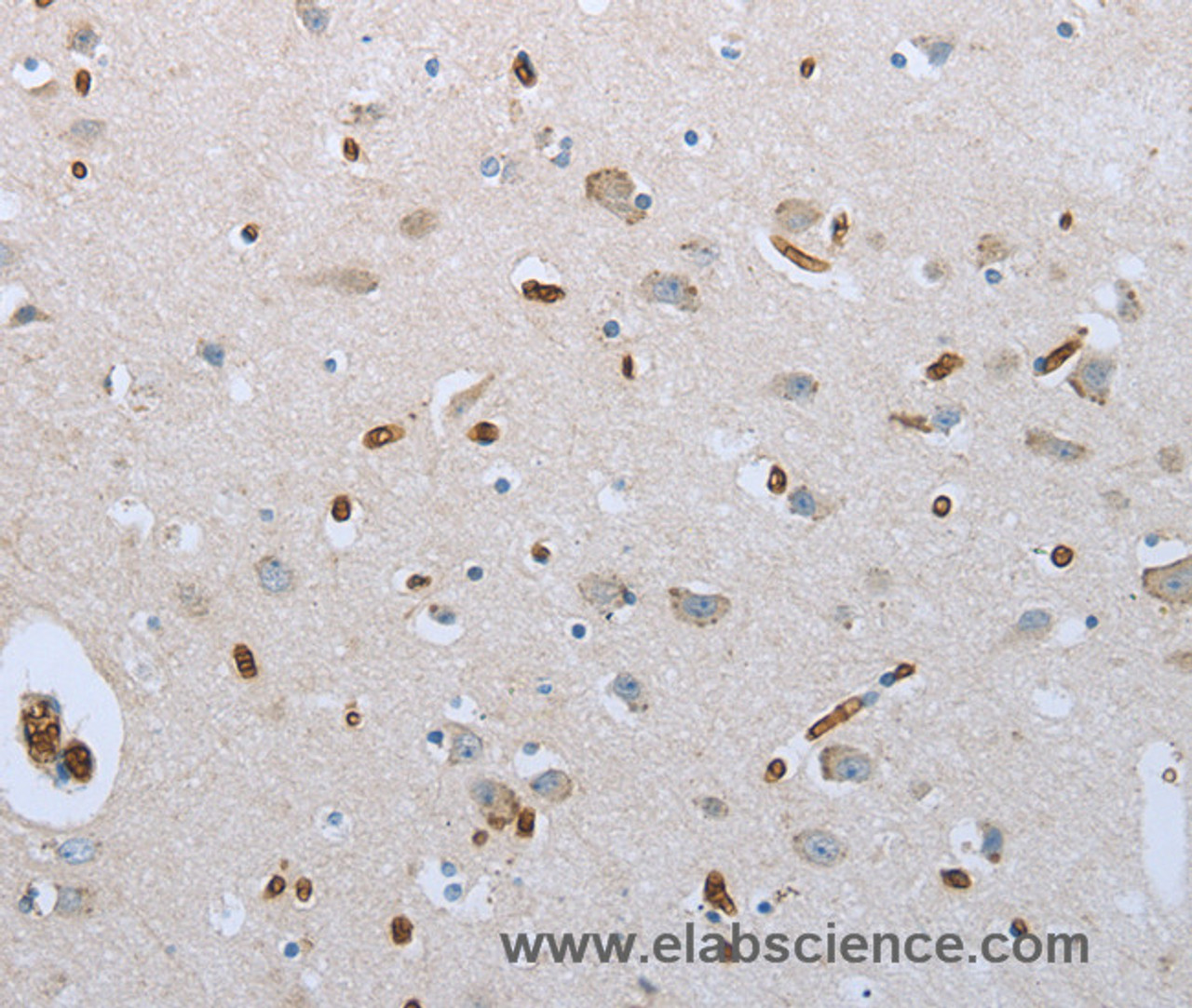 Immunohistochemistry of paraffin-embedded Human brain tissue using FGF1 Polyclonal Antibody at dilution 1:50