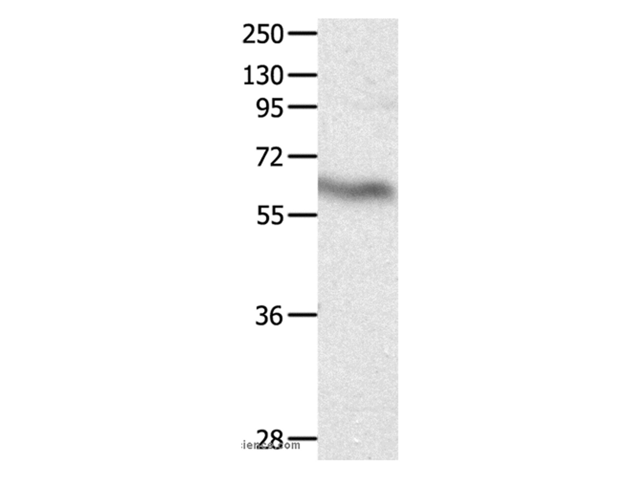 Western Blot analysis of Huamn fetal brain tissue using CRMP3 Polyclonal Antibody at dilution of 1:500