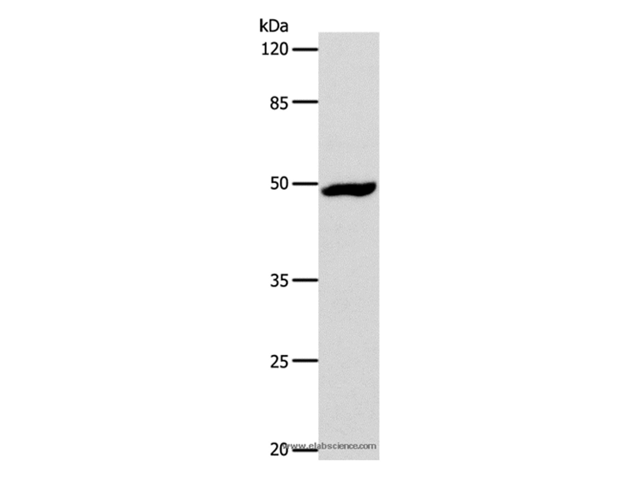 Western Blot analysis of Hela cell using DRD1 Polyclonal Antibody at dilution of 1:1000