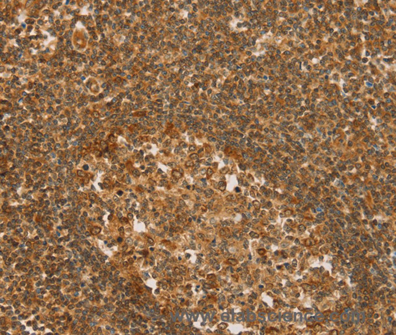 Immunohistochemistry of paraffin-embedded Human tonsil tissue using SLC6A3 Polyclonal Antibody at dilution 1:50