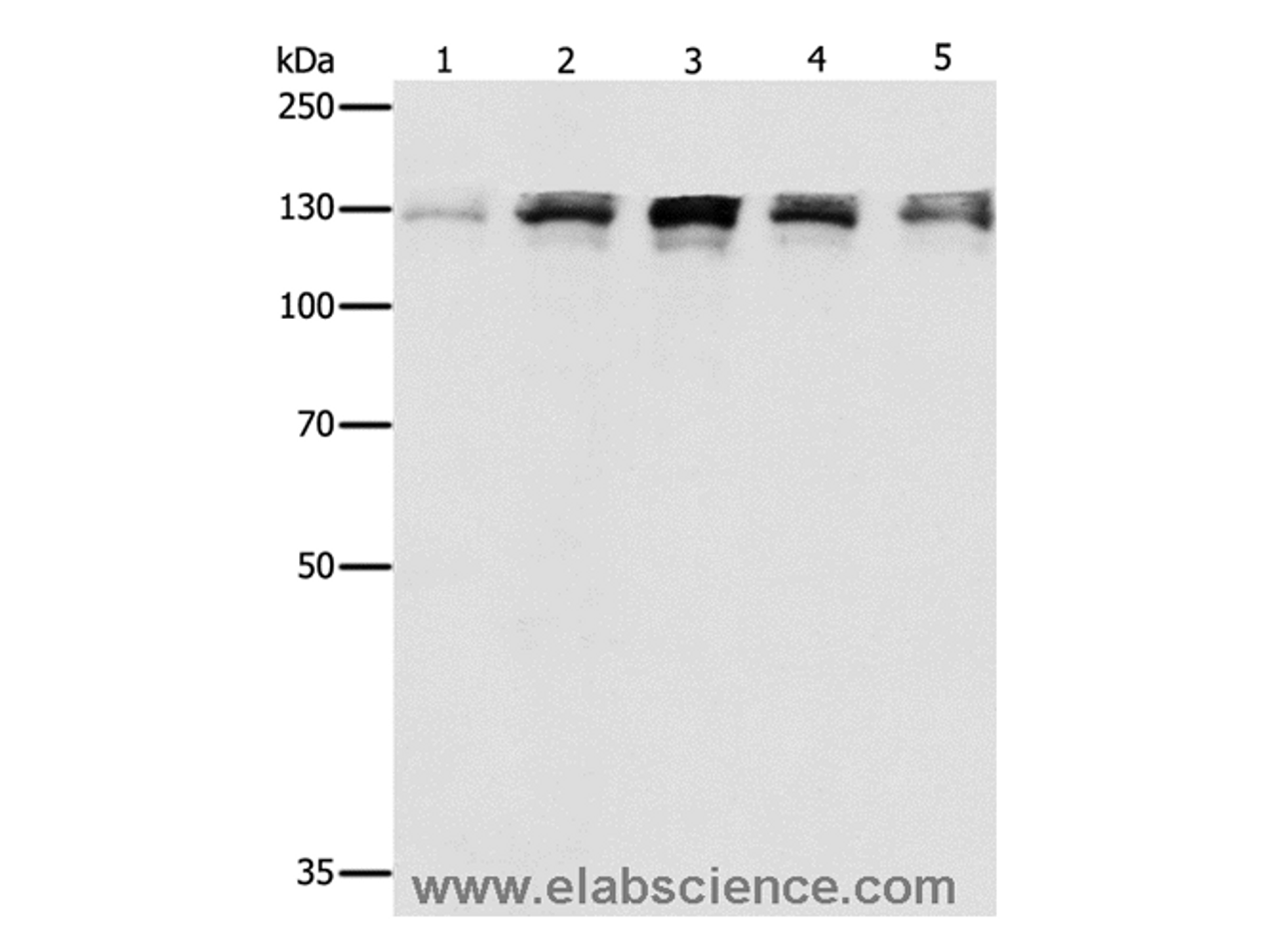 Western Blot analysis of Human fetal small intestine, liver cancer and Lymphoma Lymphoma, 293T and A549 cell using DDB1 Polyclonal Antibody at dilution of 1:500