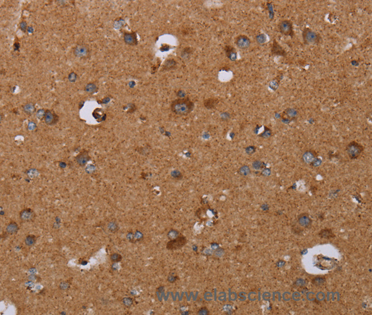 Immunohistochemistry of paraffin-embedded Human brain  tissue using DISC1 Polyclonal Antibody at dilution 1:30