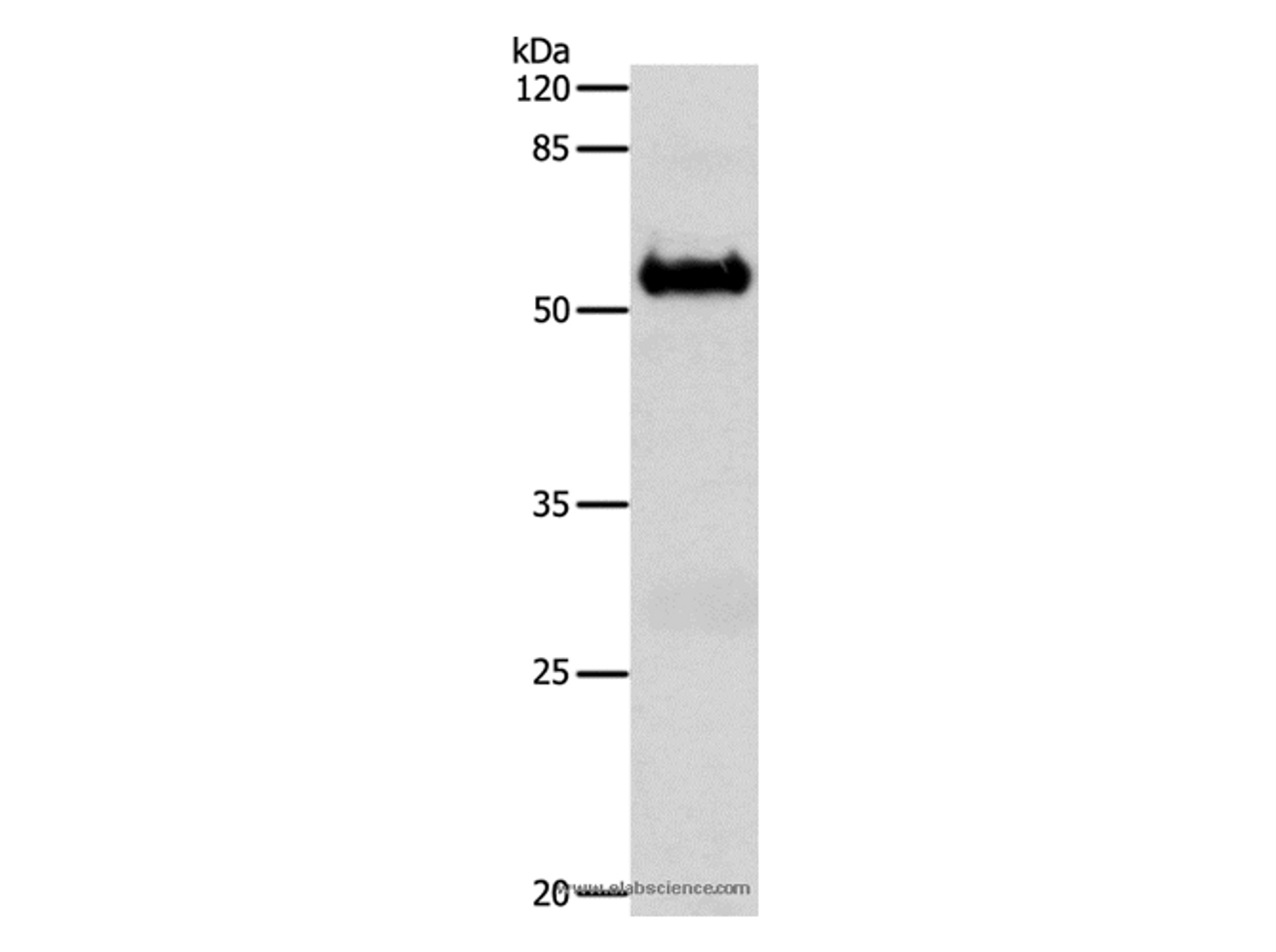 Western Blot analysis of Mouse brain tissue using SLC1A6 Polyclonal Antibody at dilution of 1:600