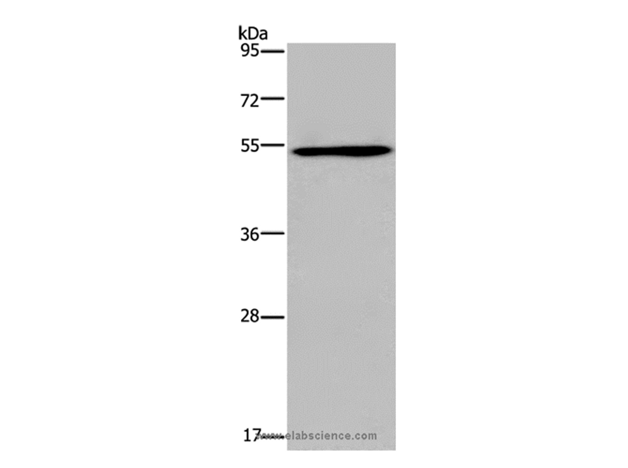 Western Blot analysis of A549 cell using EPOR Polyclonal Antibody at dilution of 1:500