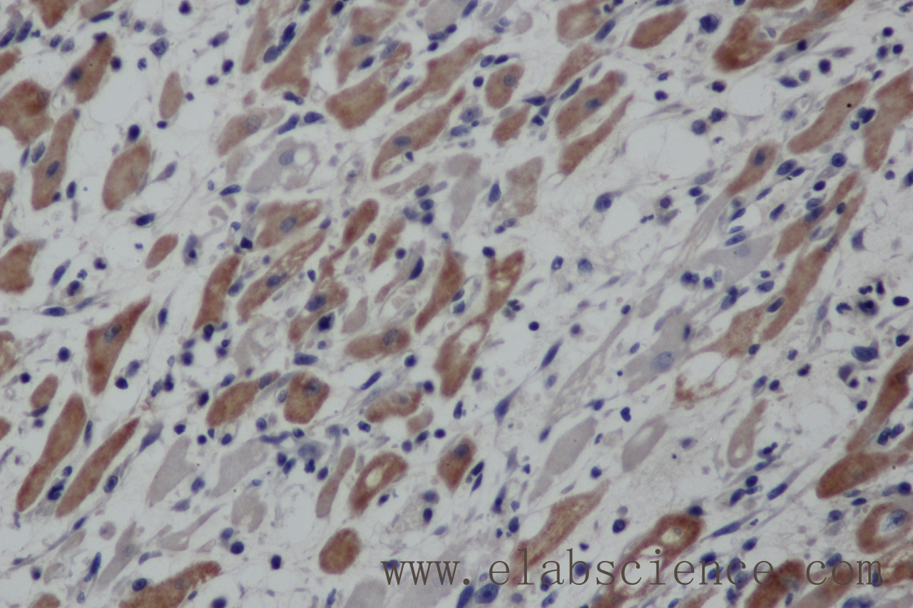 Immunohistochemistry of paraffin-embedded Mouse heart using EPOR Polyclonal Antibody at dilution of 1:50