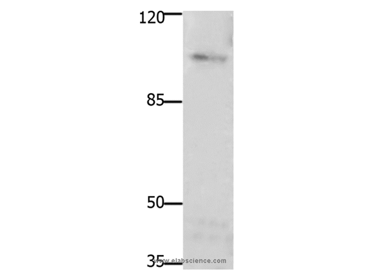 Western Blot analysis of Mouse brain tissue using FAK Polyclonal Antibody at dilution of 1:1850
