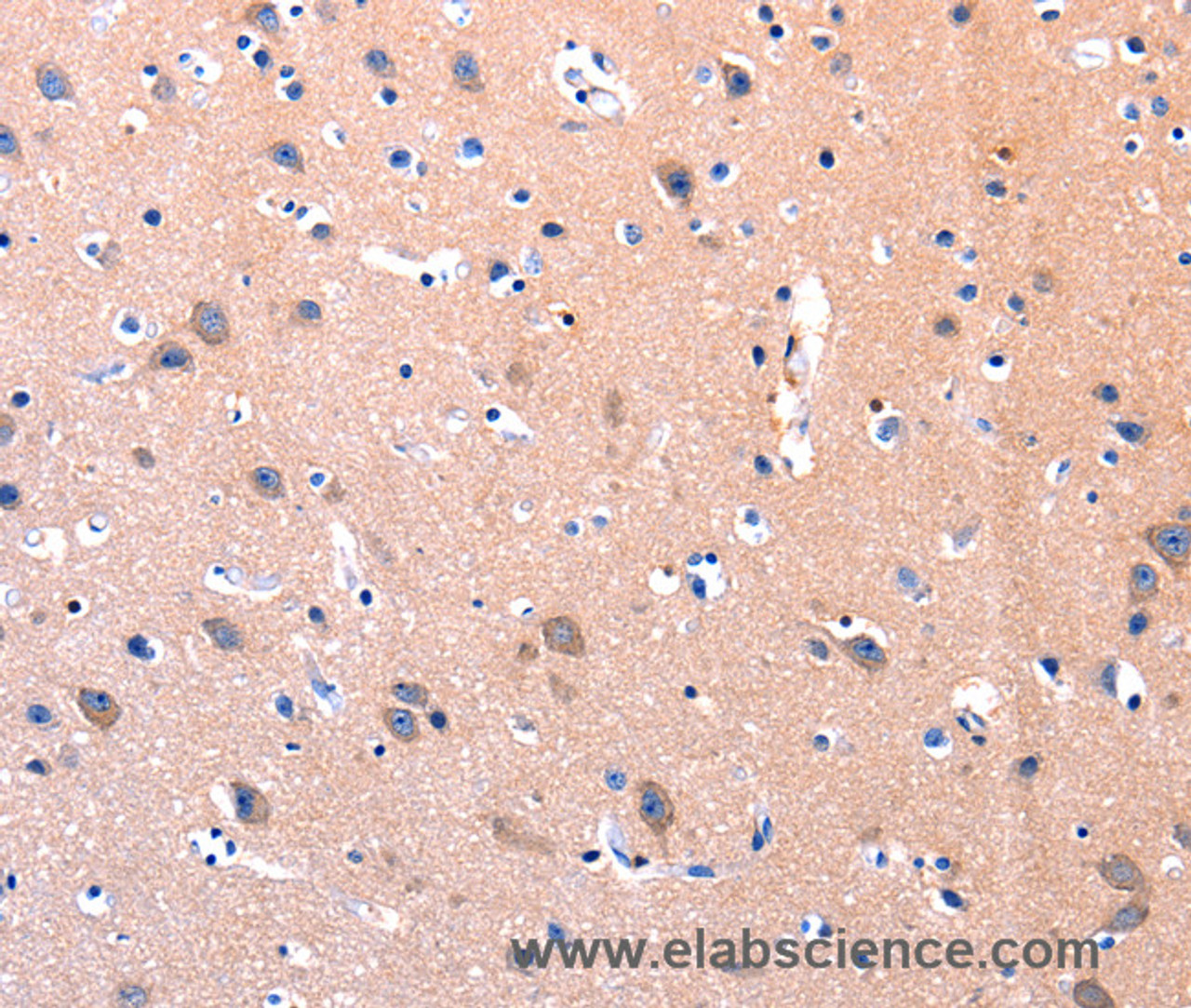 Immunohistochemistry of paraffin-embedded Human brain using FAK Polyclonal Antibody at dilution of 1:75