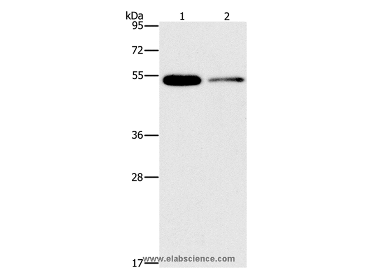 Western Blot analysis of Human placenta and Human normal liver tissue using FOXF2 Polyclonal Antibody at dilution of 1:666