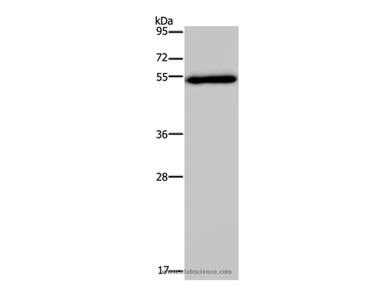 Western Blot analysis of Human breast infiltRative duct tissue using FOXC2 Polyclonal Antibody at dilution of 1:833