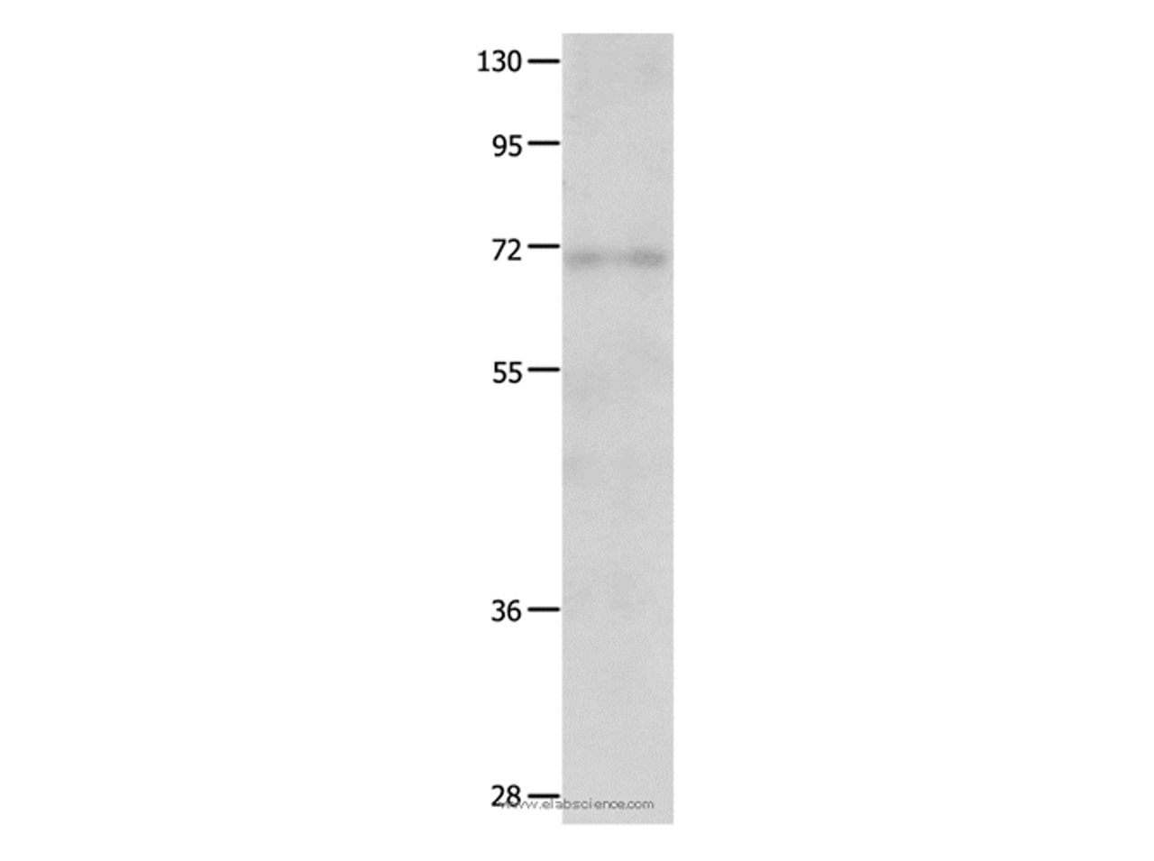 Western Blot analysis of Human fetal lung tissue   using IGF2BP1 Polyclonal Antibody at dilution of 1:500