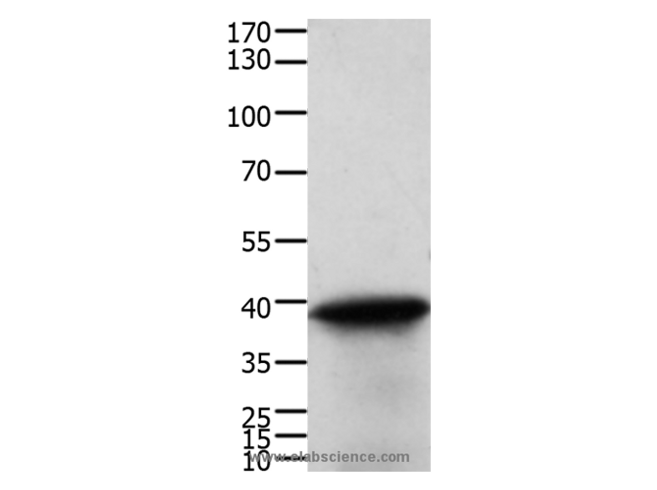 Western Blot analysis of Human cervical cancer tissue using TPM2 Polyclonal Antibody at dilution of 1:600