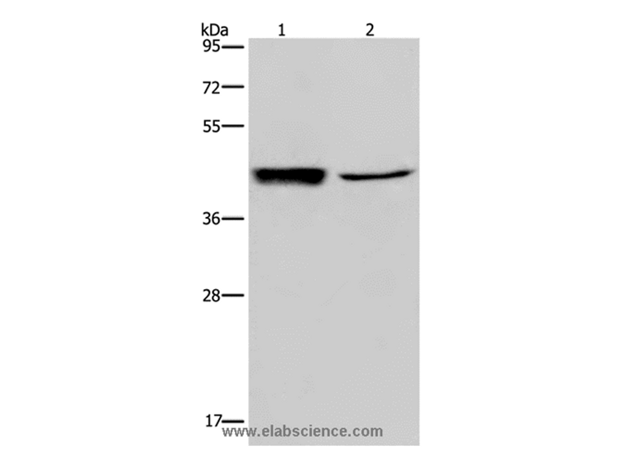 Western Blot analysis of Human hepatocellular carcinoma tissue and A549 cell using GRPR Polyclonal Antibody at dilution of 1:300