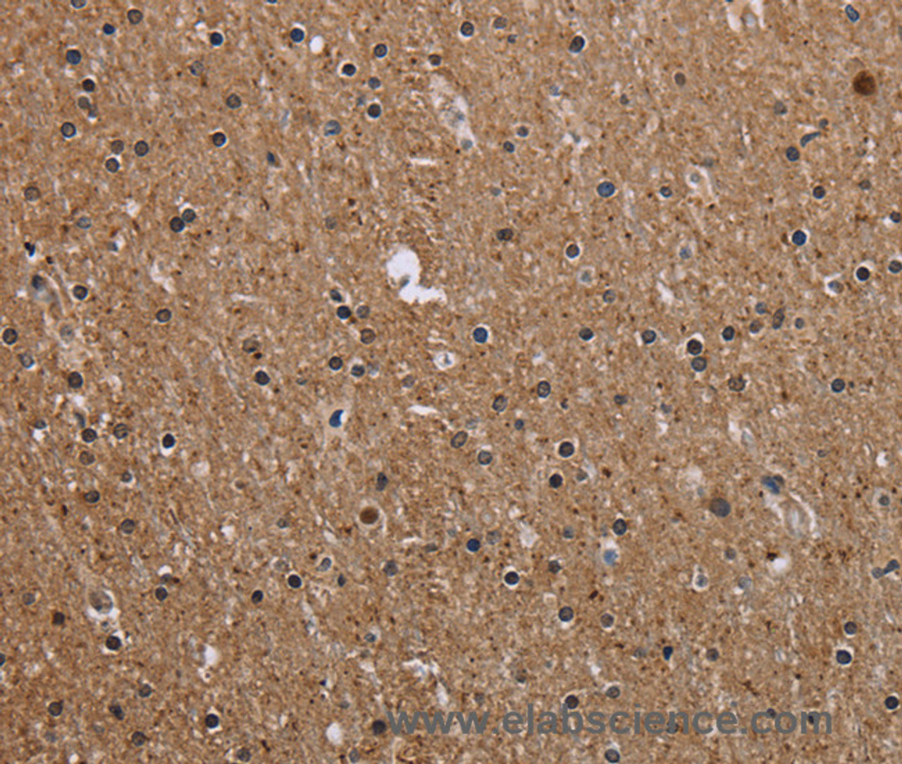 Immunohistochemistry of paraffin-embedded Human brain tissue using CMTM5 Polyclonal Antibody at dilution 1:40