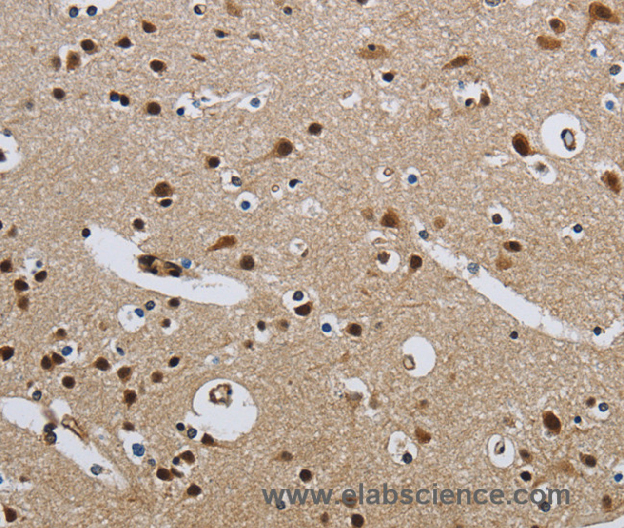 Immunohistochemistry of paraffin-embedded Human brain  tissue using CMTM8 Polyclonal Antibody at dilution 1:40