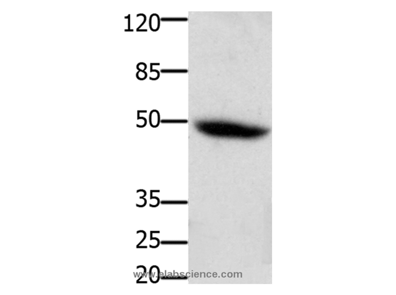 Western Blot analysis of Mouse heart tissue using CD116 Polyclonal Antibody at dilution of 1:400