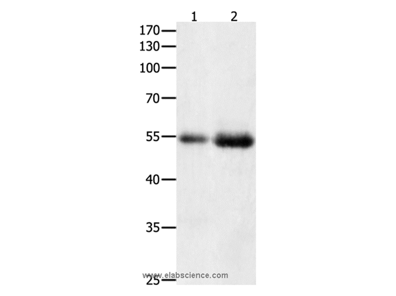 Western Blot analysis of Human colon  and  kidney cancer tissue   using HDAC1 Polyclonal Antibody at dilution of 1:400