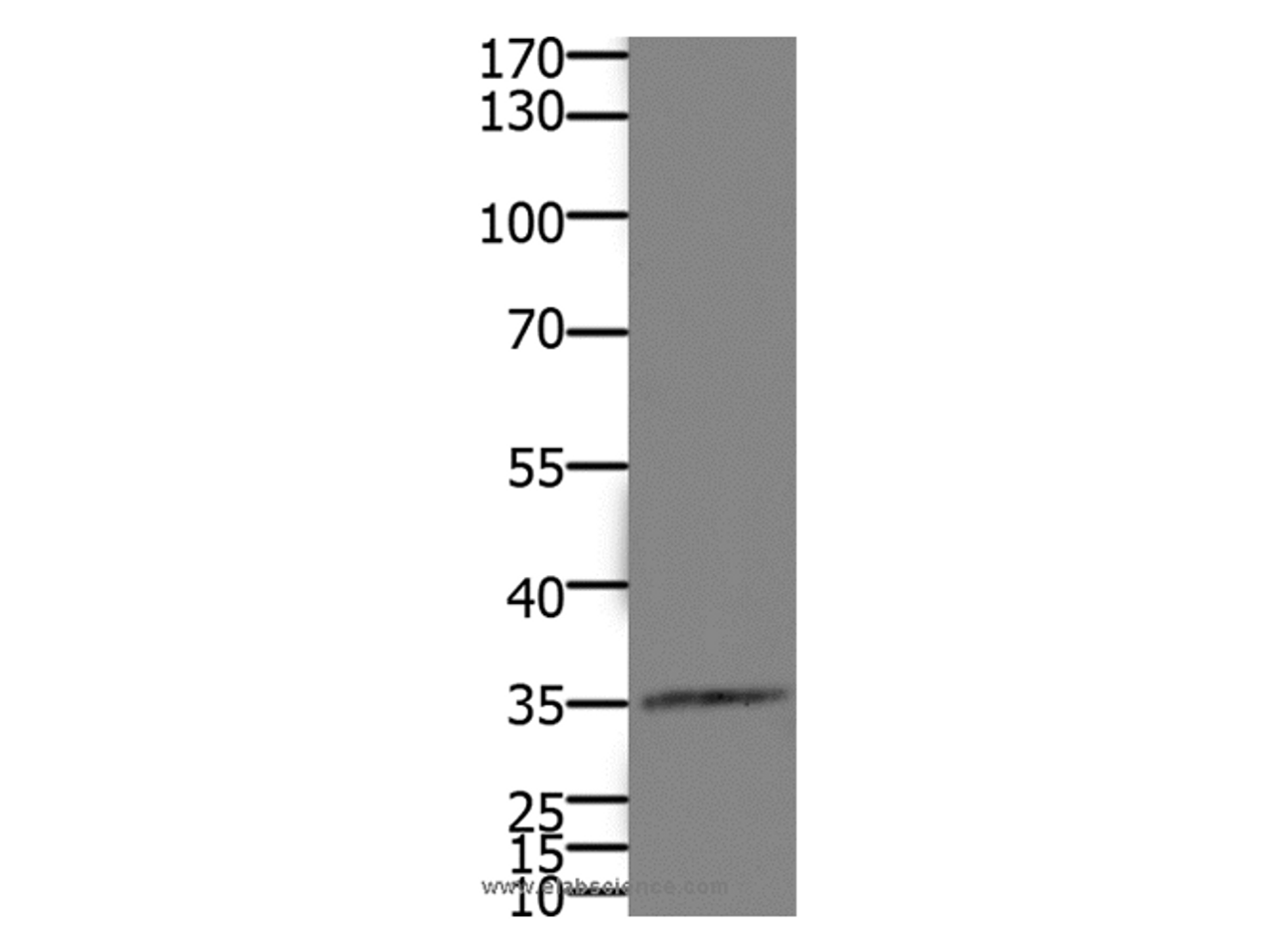 Western Blot analysis of Mouse kidney tissue using HOXD11 Polyclonal Antibody at dilution of 1:1100