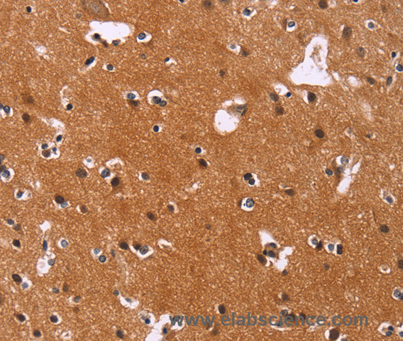 Immunohistochemistry of paraffin-embedded Human brain  using CBX3 Polyclonal Antibody at dilution of 1:40