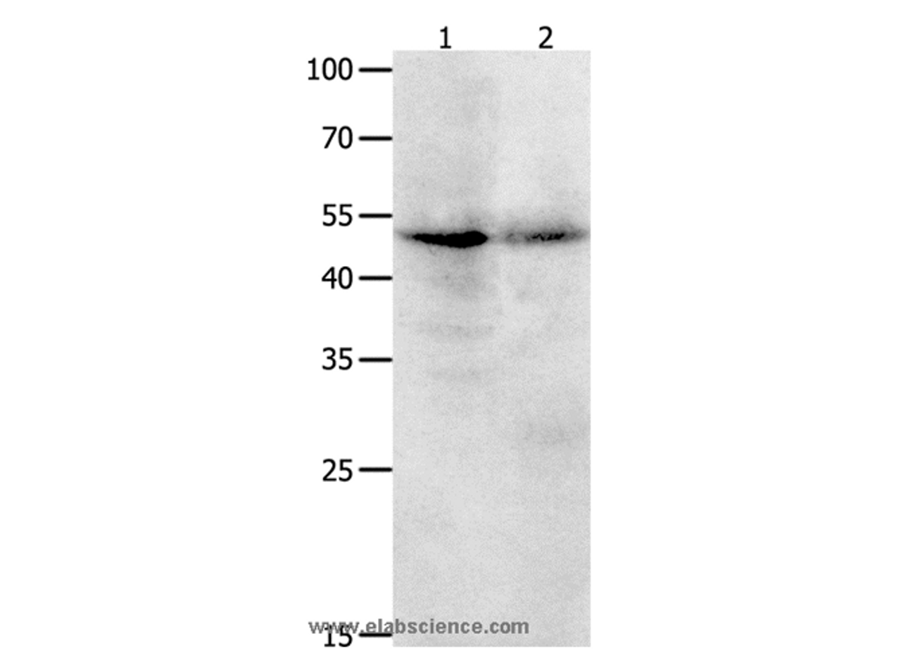 Western Blot analysis of Jurkat cell  and Human ovarian cancer tissue   using KLF5 Polyclonal Antibody at dilution of 1:1700