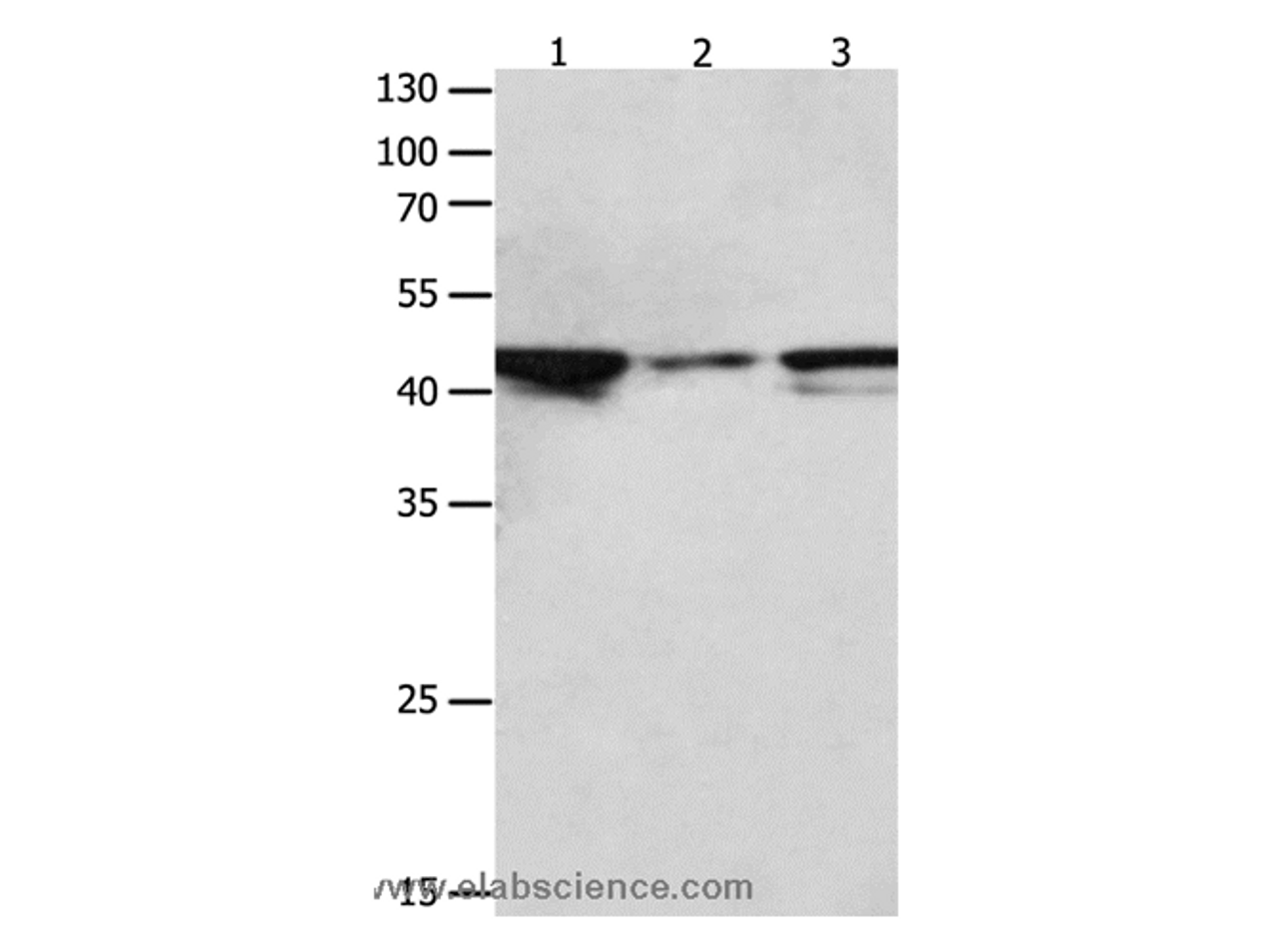 Western Blot analysis of Hela,  NIH/3T3 and Jurkat cell   using MAP2K2 Polyclonal Antibody at dilution of 1:1900