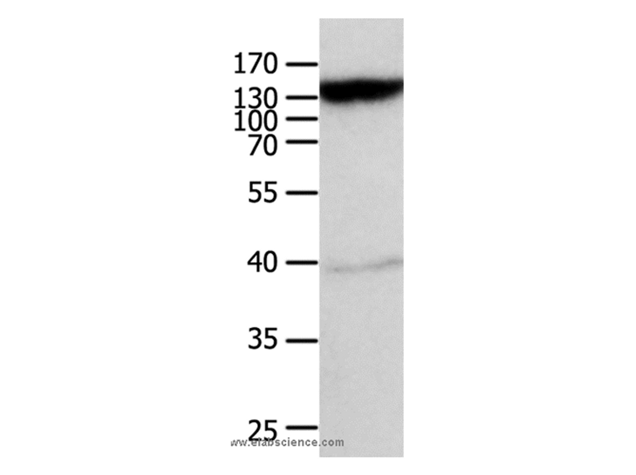 Western Blot analysis of Mouse heart tissue   using ABCC5 Polyclonal Antibody at dilution of 1:950