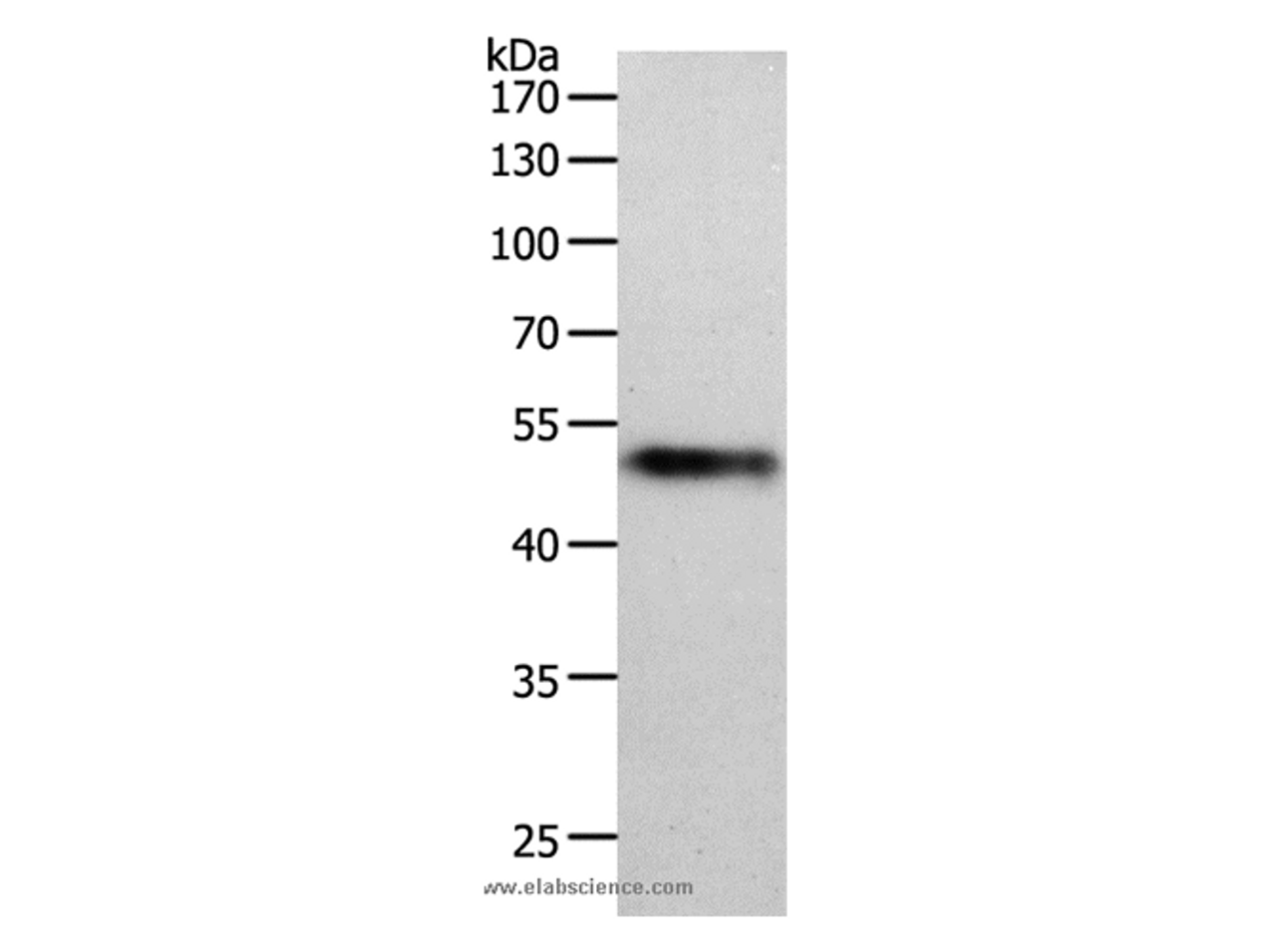 Western Blot analysis of Human lung tissue using MIDN Polyclonal Antibody at dilution of 1:1000