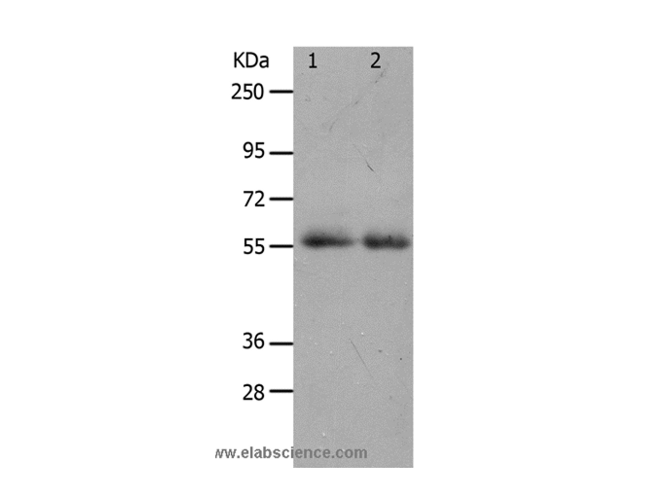 Western Blot analysis of K562 cell and Human colon cancer tissue using MMP17 Polyclonal Antibody at dilution of 1:900