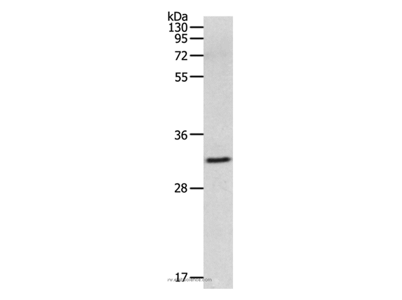 Western Blot analysis of 293T cell using MMP26 Polyclonal Antibody at dilution of 1:500