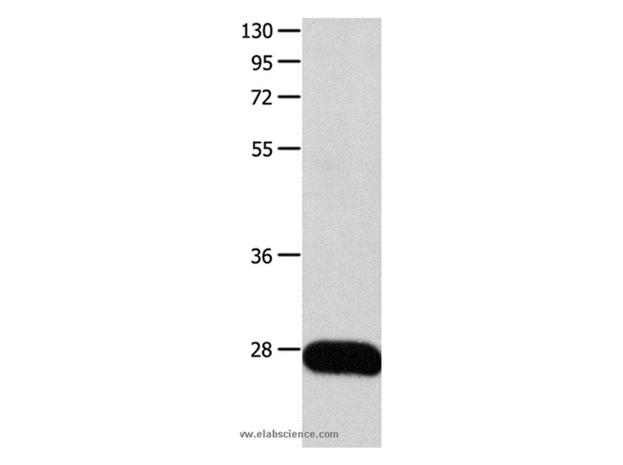 Western Blot analysis of Human liver cancer tissue   using POMC Polyclonal Antibody at dilution of 1:450