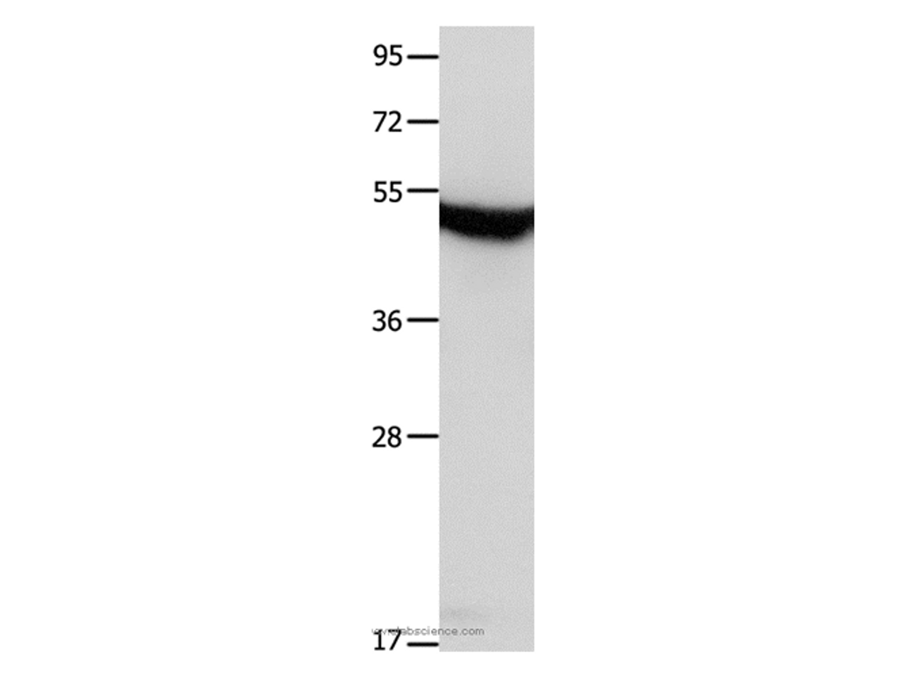 Western Blot analysis of Mouse brain tissue using MTNR1A Polyclonal Antibody at dilution of 1:650