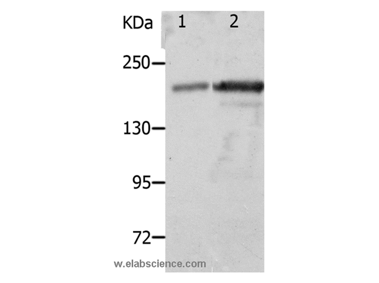 Western Blot analysis of Mouse spleen and kidney tissue using NPHS1 Polyclonal Antibody at dilution of 1:800