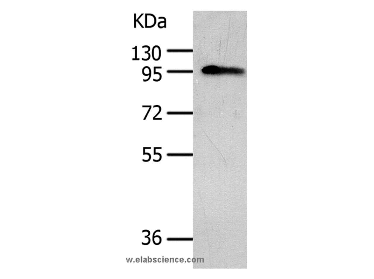 Western Blot analysis of Human liver cancer tissue using AKAP8 Polyclonal Antibody at dilution of 1:500