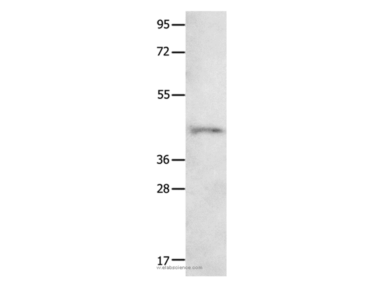 Western Blot analysis of 231 cell   using NTSR1 Polyclonal Antibody at dilution of 1:800