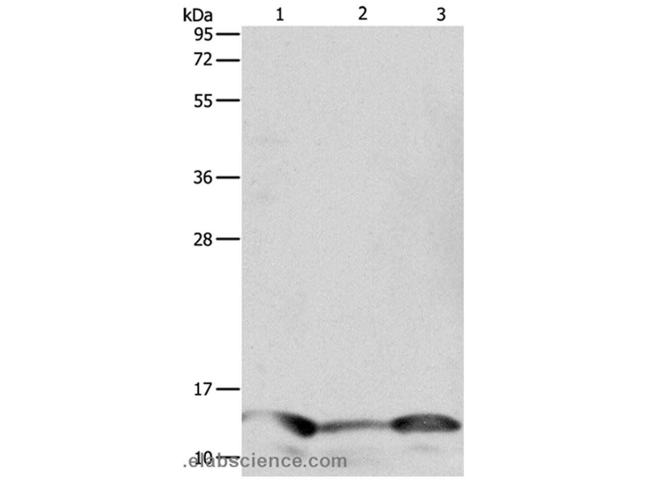 Western Blot analysis of Human seminoma tissue, hela and A549 cell using PFN1 Polyclonal Antibody at dilution of 1:1000
