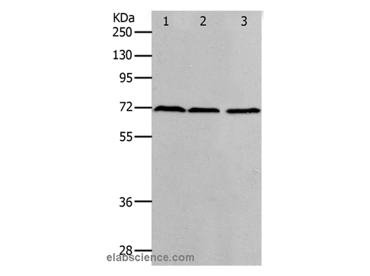 Western Blot analysis of K562, hela and 293T cell using PRMT5 Polyclonal Antibody at dilution of 1:400