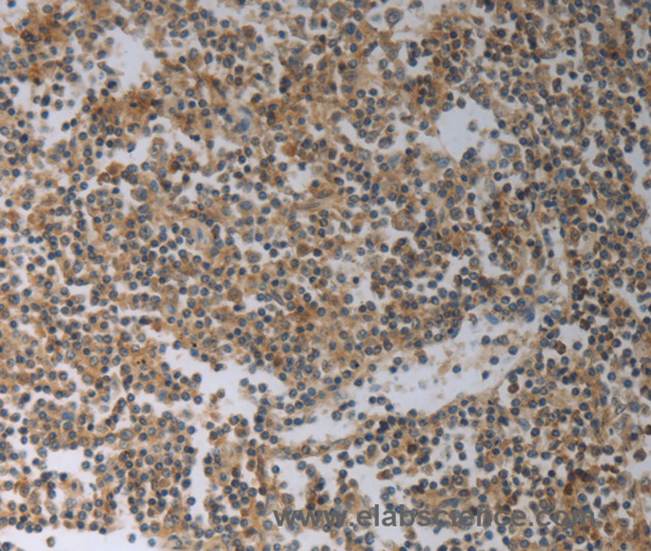 Immunohistochemistry of paraffin-embedded Human tonsil tissue using SLC4A7 Polyclonal Antibody at dilution 1:50