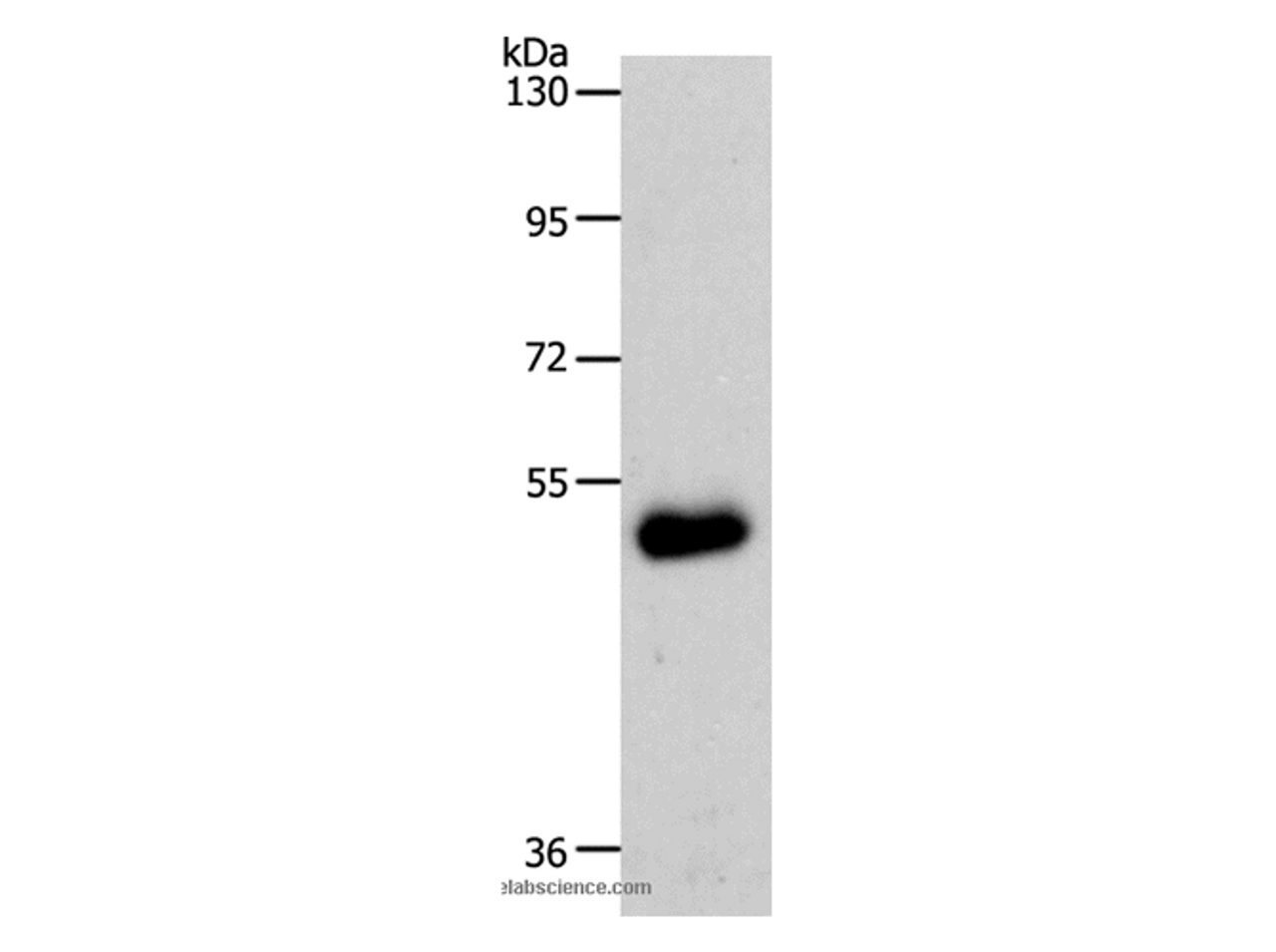 Western Blot analysis of Human colon cancer tissue using SLC39A6 Polyclonal Antibody at dilution of 1:500