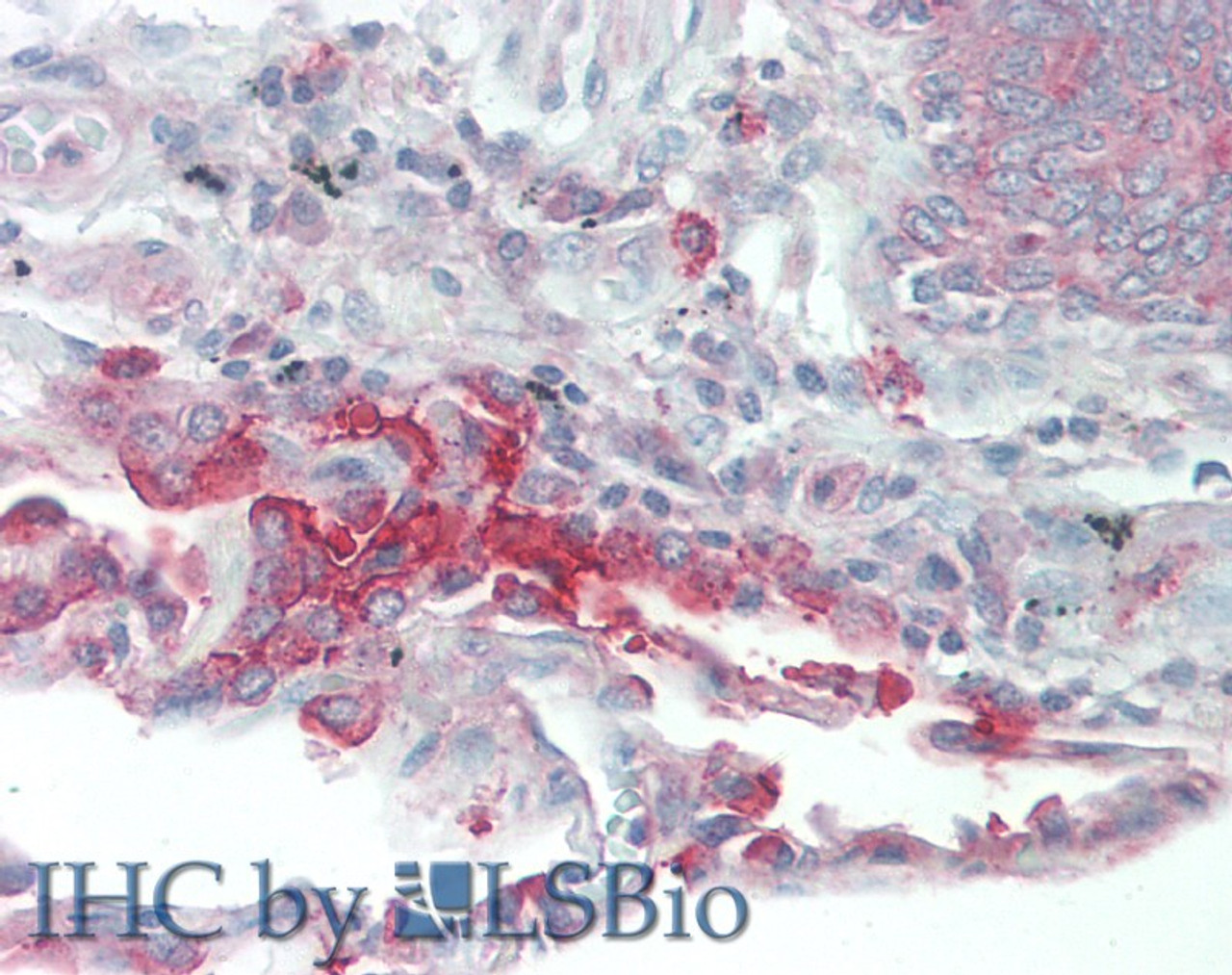 Immunohistochemistry of paraffin-embedded Human Lung tissue using SLC34A2 Polyclonal Antibody at dilution of 1:60(Elabscience® Product Detected by Lifespan).