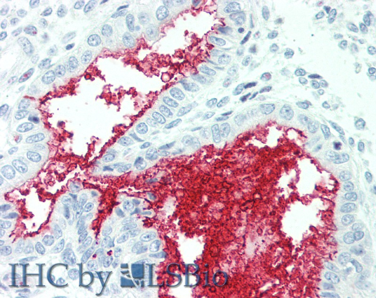 Immunohistochemistry of paraffin-embedded Human Uterus tissue using SLC34A2 Polyclonal Antibody at dilution of 1:60(Elabscience® Product Detected by Lifespan).