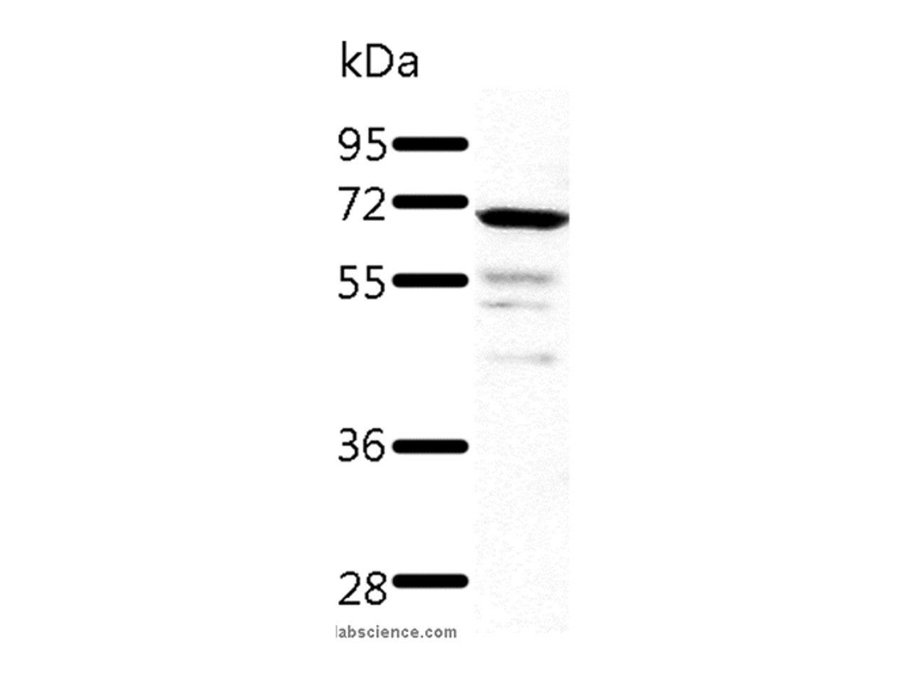 Western Blot analysis of Human fetal kidney tissue using TRAF3 Polyclonal Antibody at dilution of 1:500
