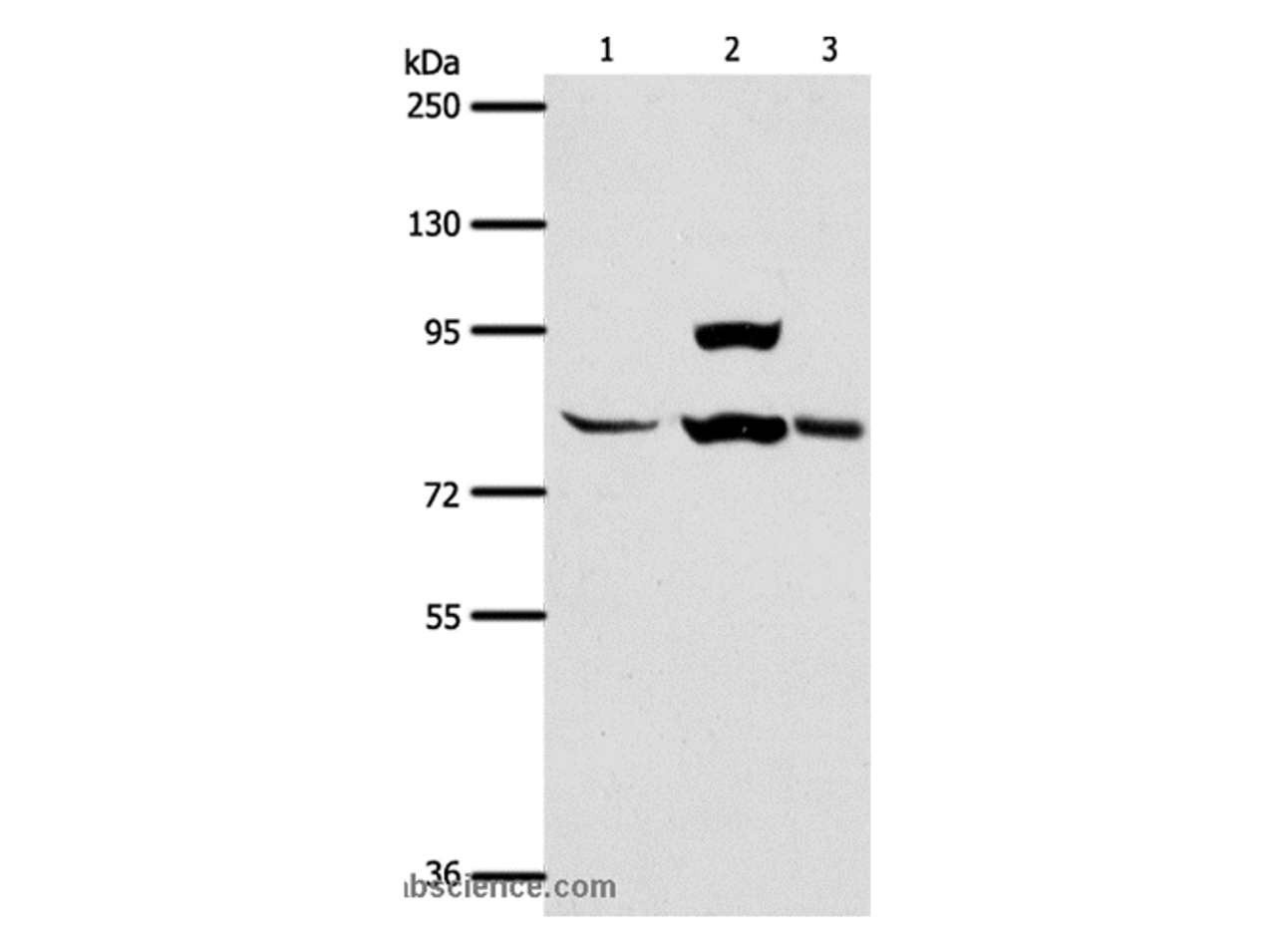 Western Blot analysis of Human liver cancer tissue, hela cell and Mouse lung tissue using AGAP1 Polyclonal Antibody at dilution of 1:400
