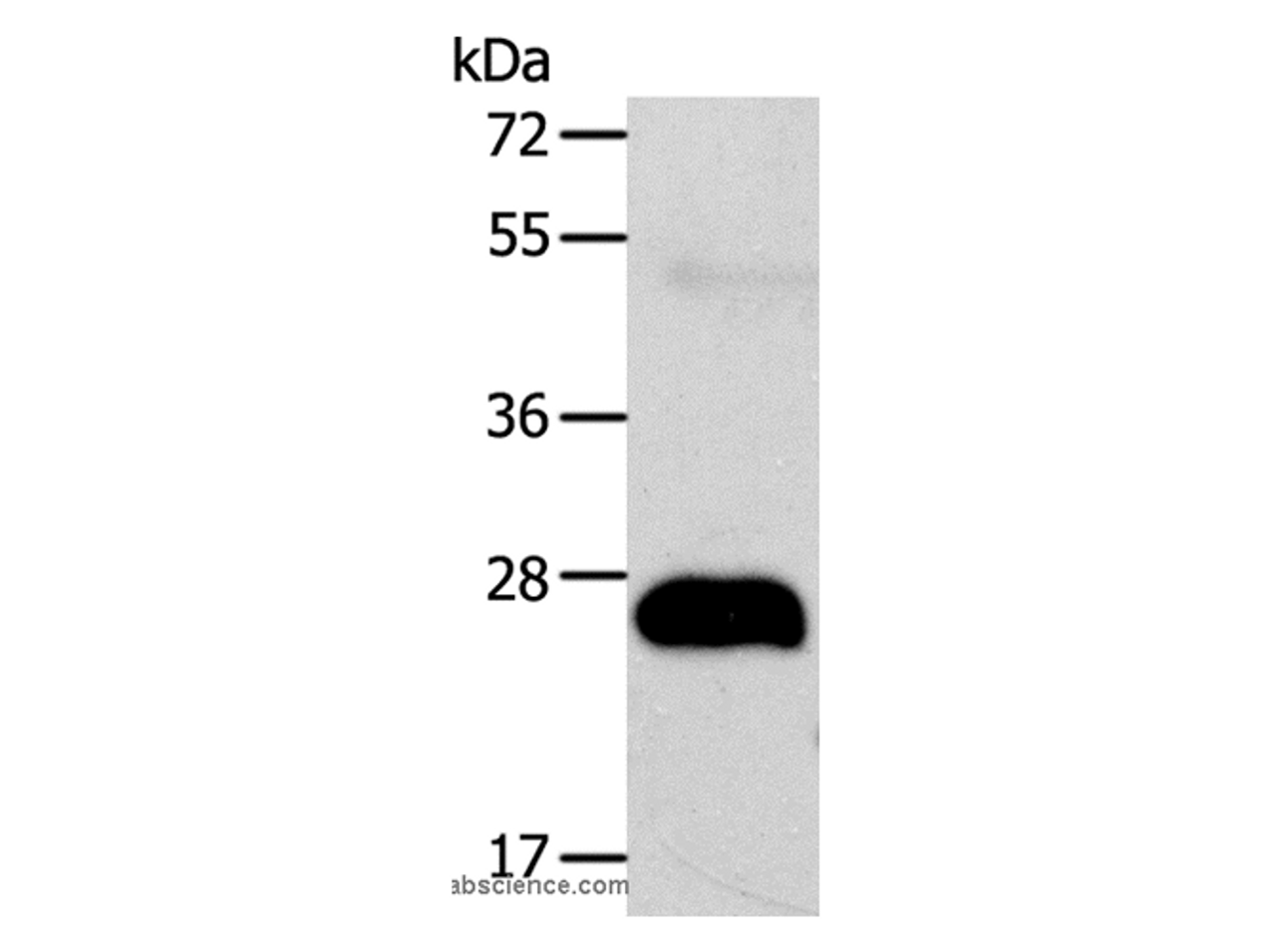 Western Blot analysis of Human fetal liver cancer tissue using AGPAT2 Polyclonal Antibody at dilution of 1:400