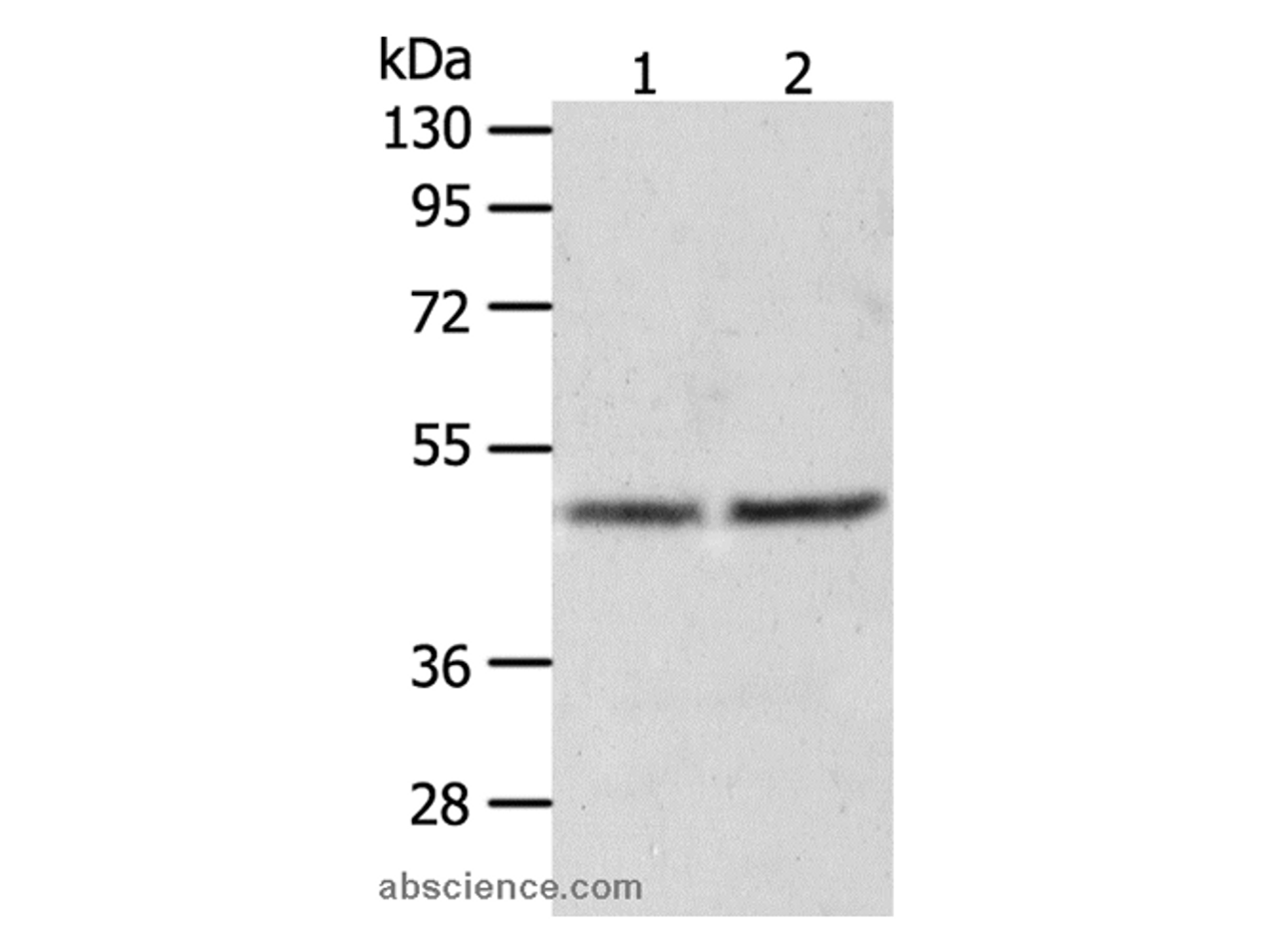 Western Blot analysis of Human fetal liver tissue and hepg2 cell using AGXT Polyclonal Antibody at dilution of 1:1050